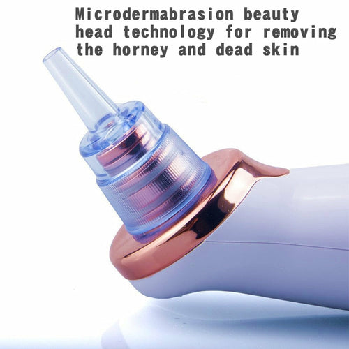 Electric Vacuum Facial Blackhead Remover Machine.